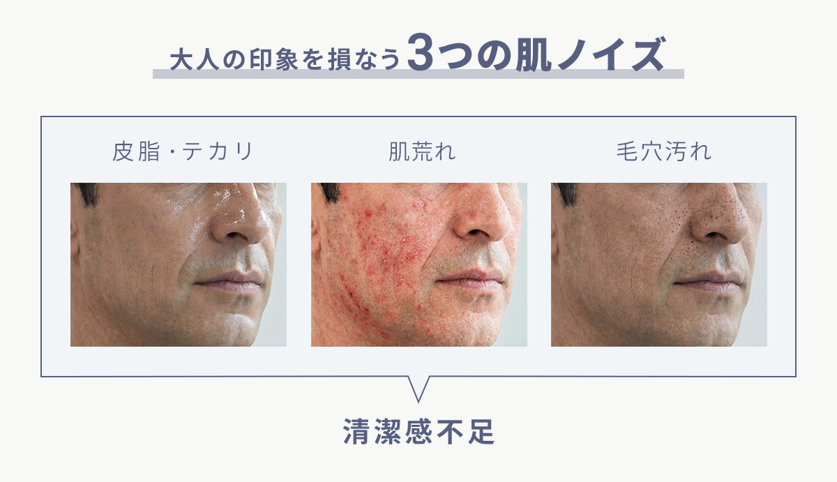 大人の印象を損なう、3つの肌ノイズ
