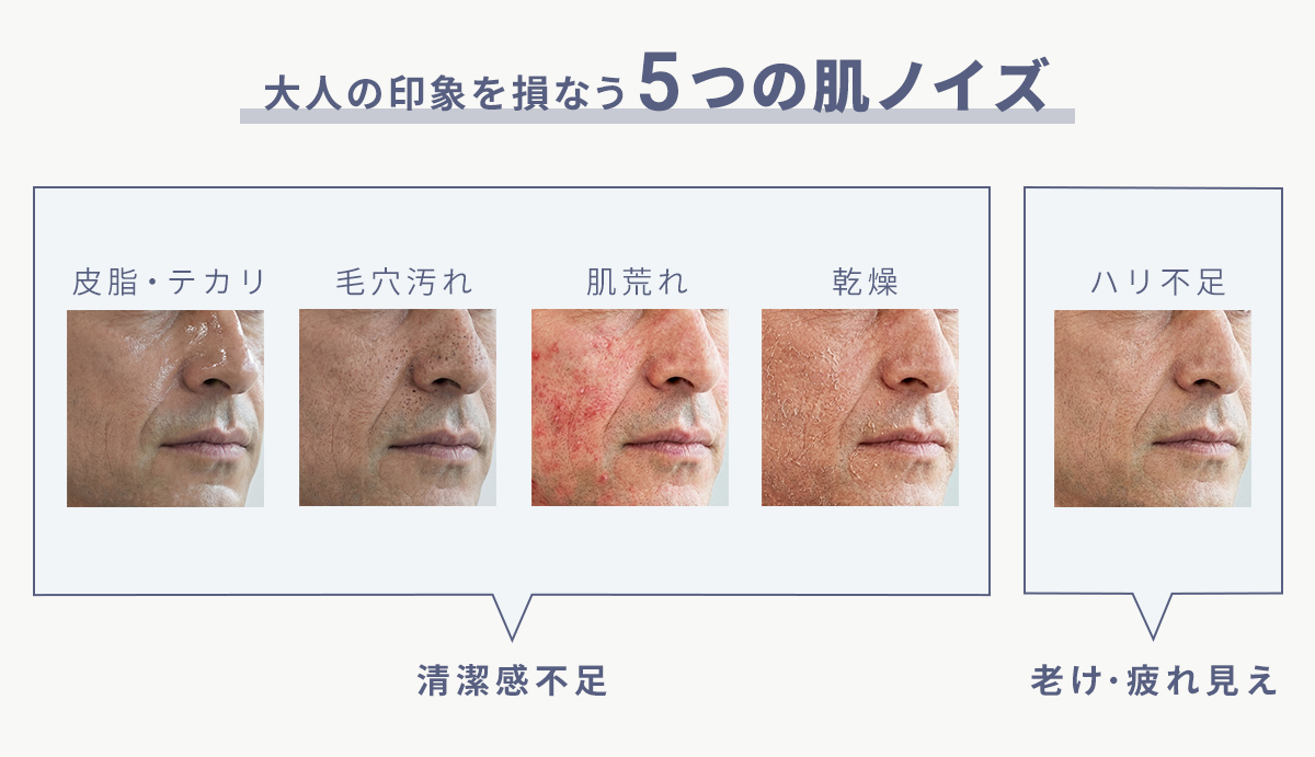 大人の印象を損なう、5つの肌ノイズ。