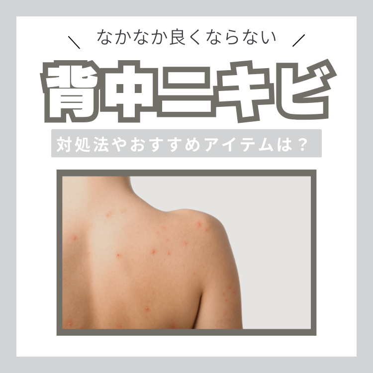 背中ニキビのケア方法を伝授！予防策&メンズにおすすめのアイテムも紹介 | AUEN [オーエン]（旧DCOLLECTION）