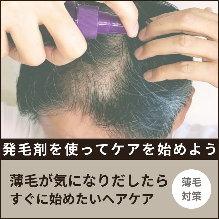 発毛促進剤の選び方とメンズにおすすめのアイテム11選！効果や育毛剤との違いをチェック